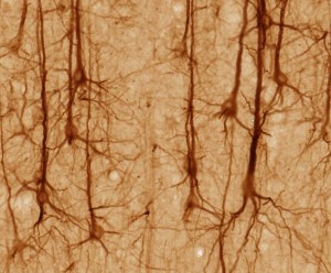 Neurons - creative commons (image by UC Regents)